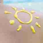 4 Quick Home Remedies to Ease Sunburn Pains